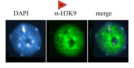 H3K9 Acetyl