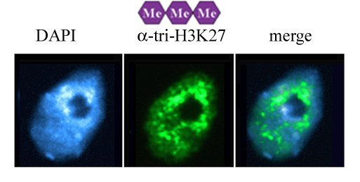 H3K27 Trimethyl