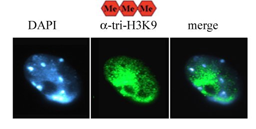 H3K9 Trimethyl