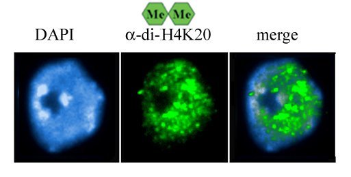 H4K20 Dimethyl