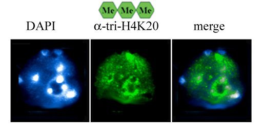 H4K20 Trimethyl